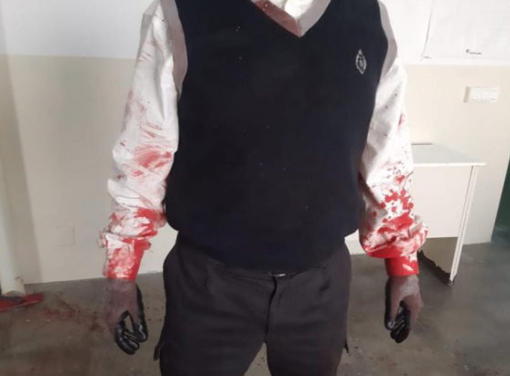 Brutal agresión a funcionarios en la prisión de Melilla