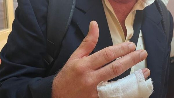 Un funcionario de ‘El Acebuche’ acaba con un dedo roto al mediar en una pelea multitudinaria